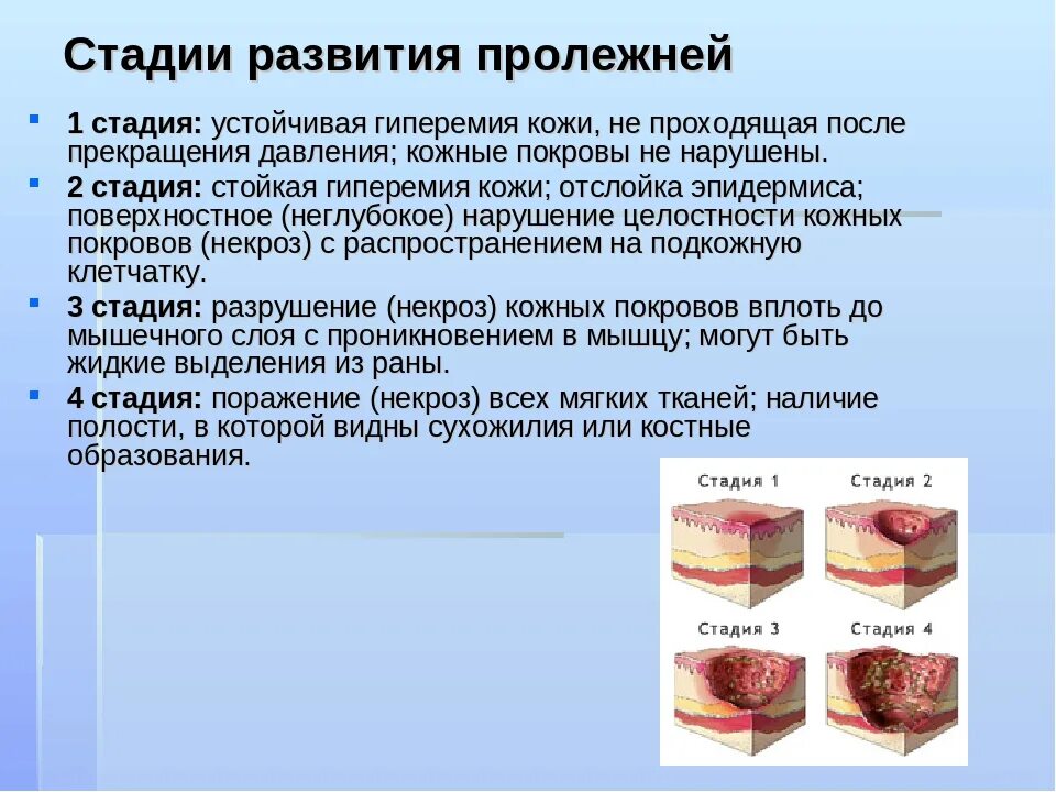 Пролежни 4 стадии фото на человеке Чем лечить пролежни у лежачих больных эффективно: найдено 88 изображений