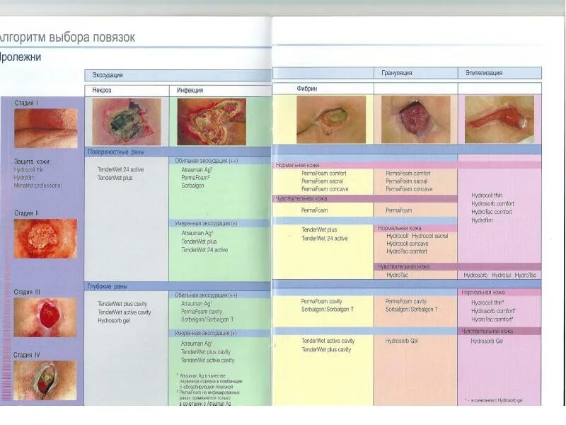 Пролежни стадии и лечение фото УХОД ЗА ПАЦИЕНТОМ ПРОЛЕЖНИ - L89 (МКБ10) профилактика и лечение