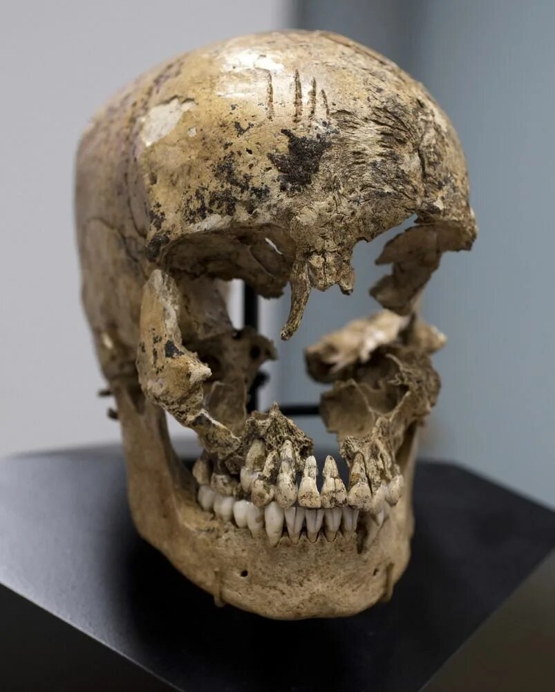 Проломленный череп фото CSI Jamestown: Anthropologists lay out evidence of colonial cannibalism - Cosmic