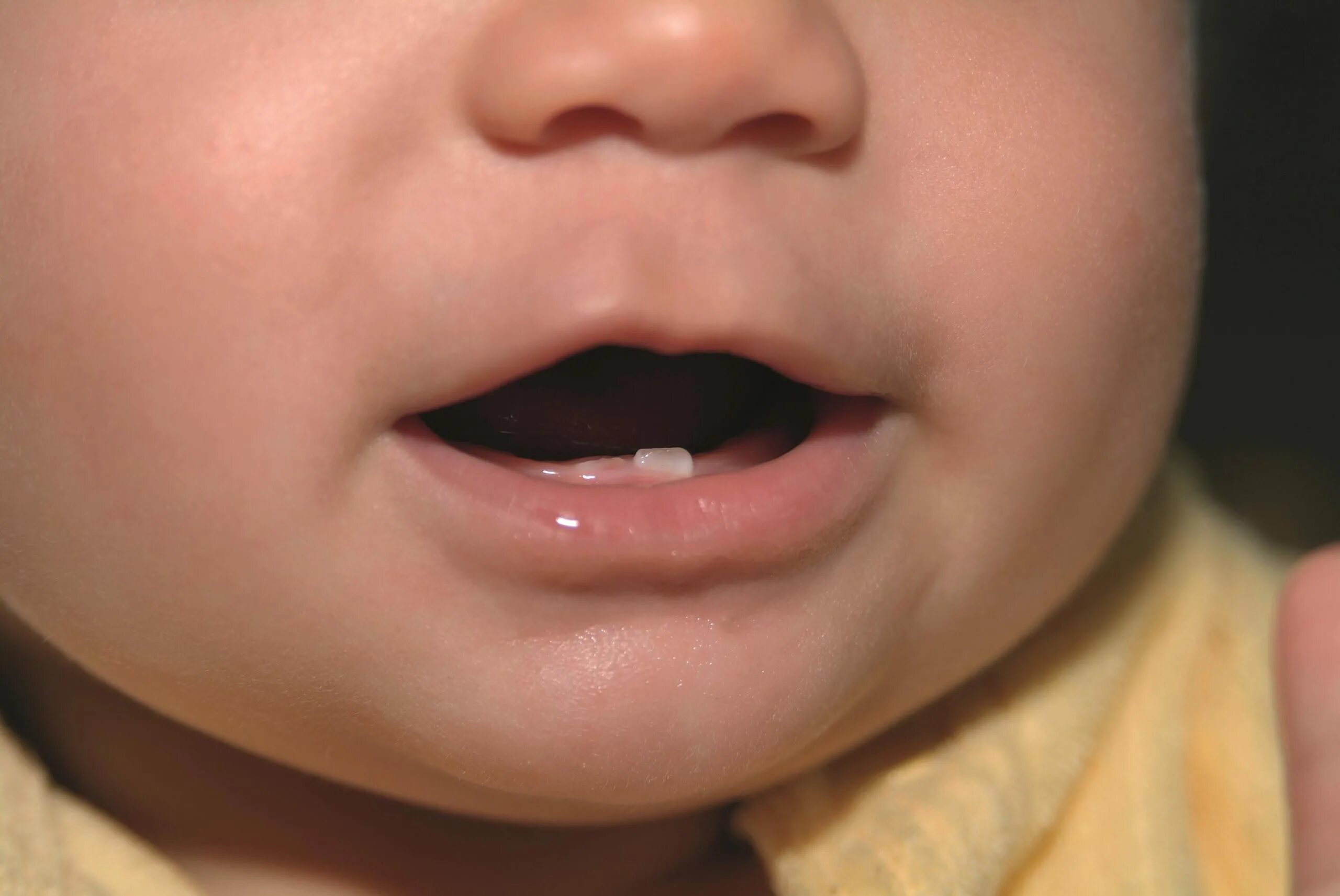 Прорезывание верхних резцов фото Tooth eruption and teething in children - The Pharmaceutical Journal