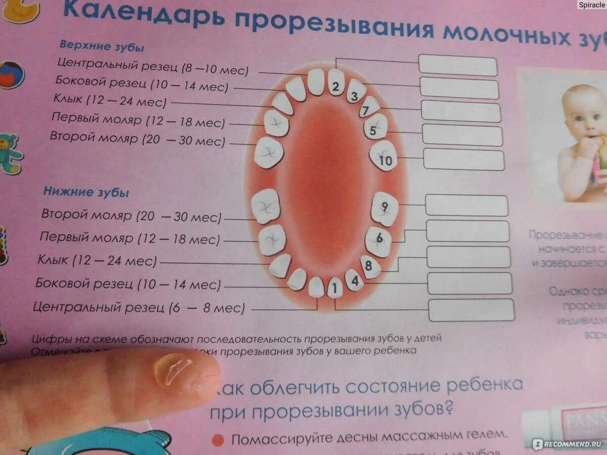 Прорезывание зубов до года фото Режется в 2 года - найдено 90 картинок