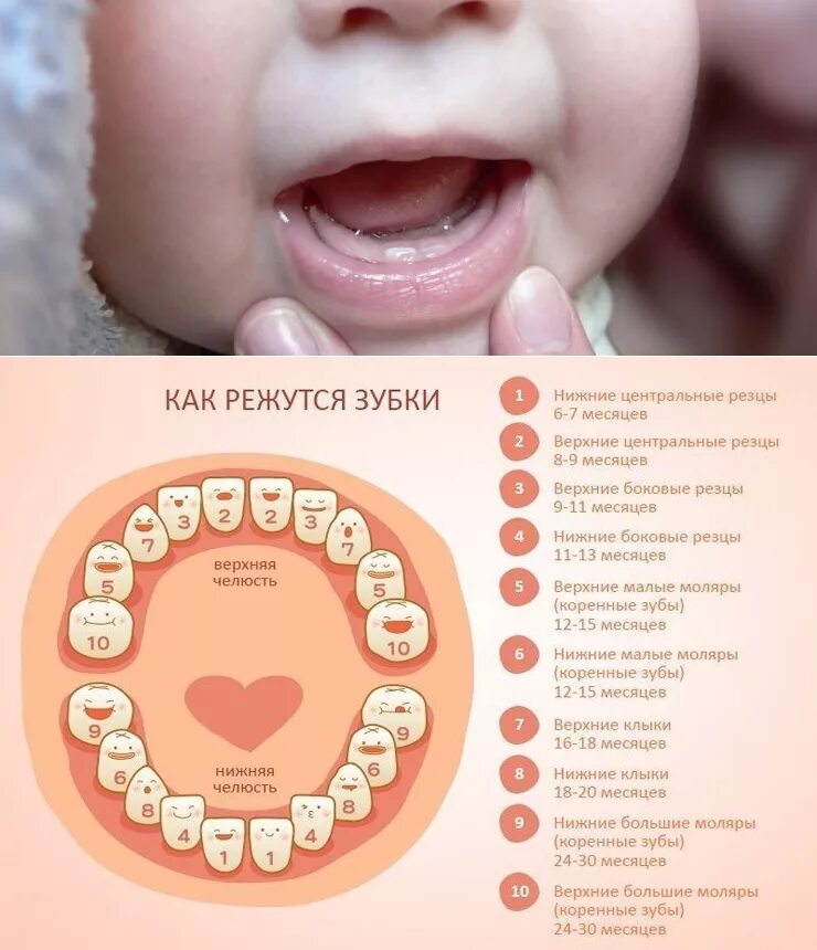 Прорезывание зубов до года фото Картинки ЗУБЫ 2 2 ПРОРЕЗЫВАЮТСЯ