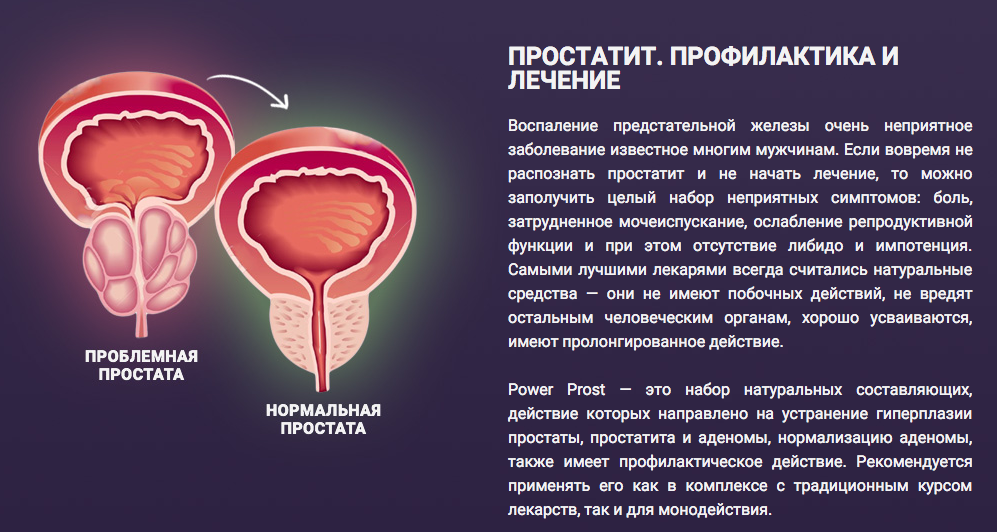 Простата это простыми словами фото у мужчин Чем отличается аденома простаты от простатита