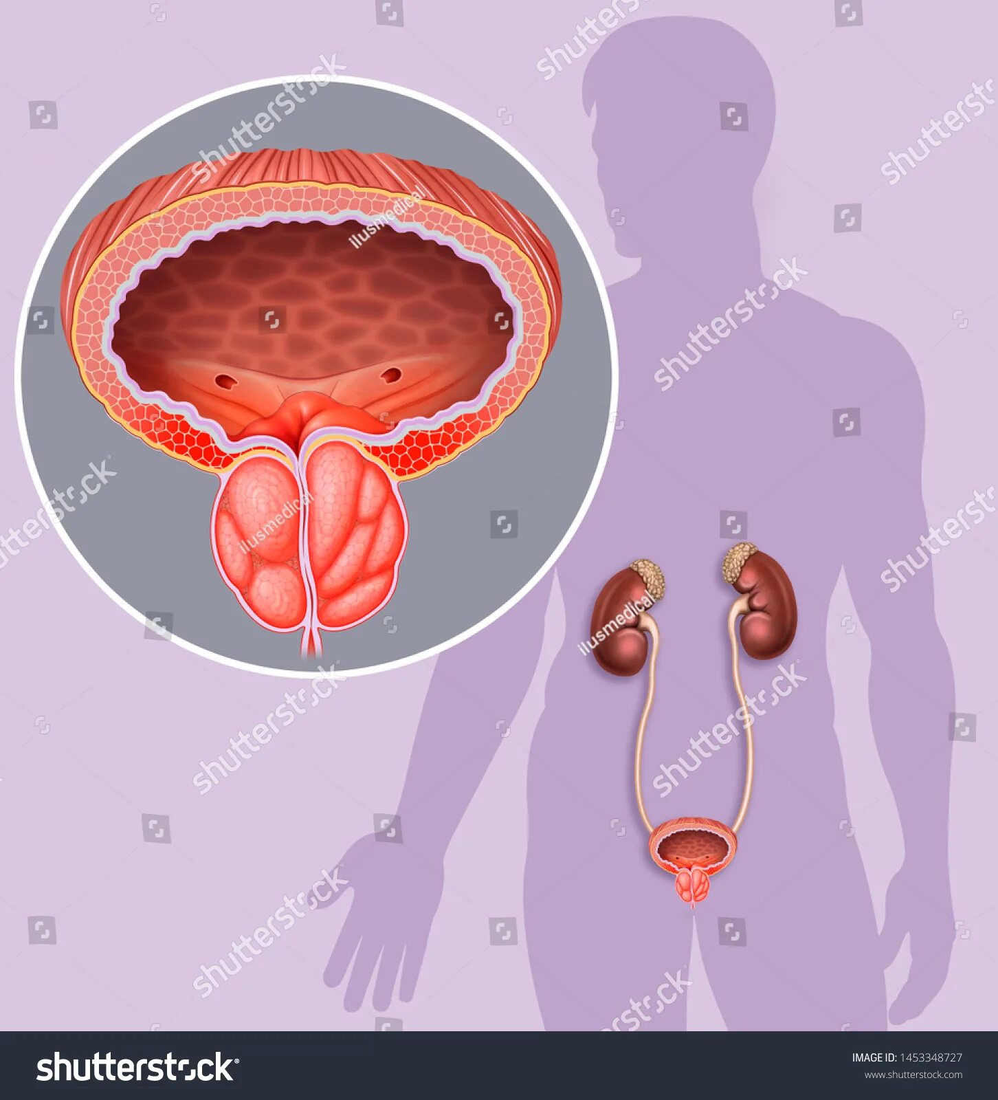 Простата снаружи фото ५,६११ Prostate gland प्रतिमा, स्टॉक फोटोज आणि वेक्टर्स Shutterstock