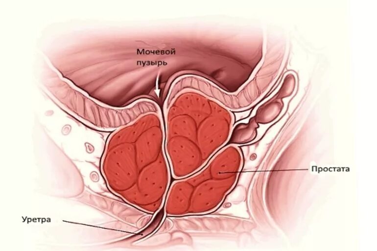 Простата у мужчин что это такое фото Воспаление простаты: причины и симптомы патологического процесса, лечение предст