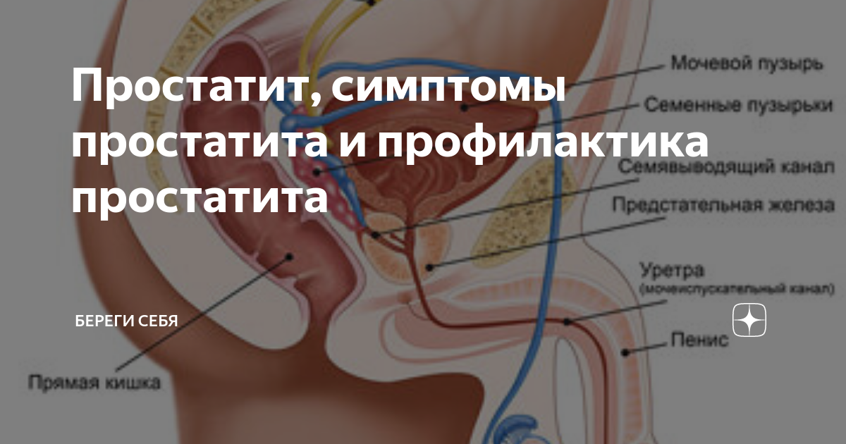 Простатит симптомы фото Простатит, симптомы простатита и профилактика простатита Береги себя Дзен