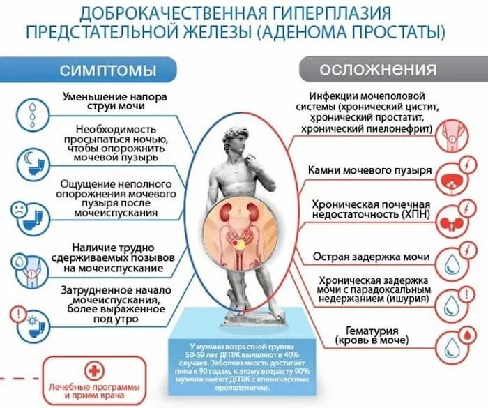 Простатит симптомы фото ДГПЖ 2 степени: симптомы и лечение, нужна ли операция, эхопризнаки диагноза, лек