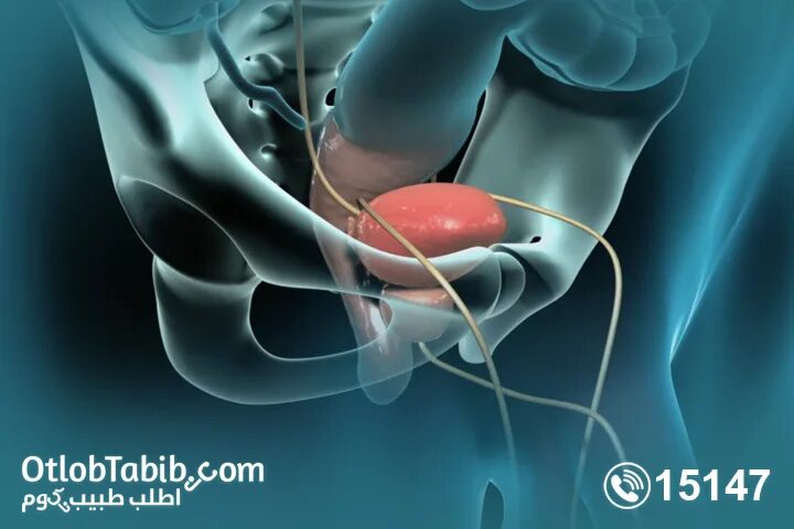 Простатиты симптомы и лечение фото What is prostate enlargement, its causes and methods of treatment