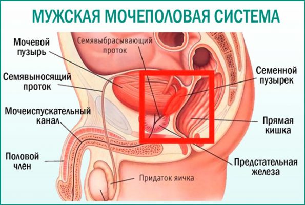 Простатиты симптомы мужчин лечение фото Обострение хронического простатита симптомы и лечение - Лечение простатита