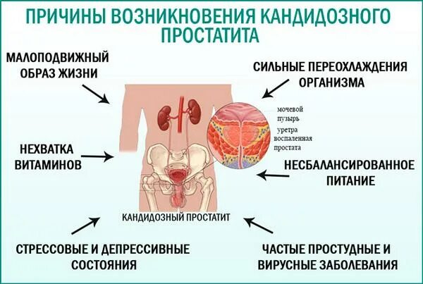 Простатиты симптомы мужчин лечение фото Жжение в мочеиспускательном канале при простатите - Разновидности болей и возмож