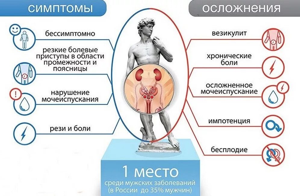 Простатиты симптомы мужчин лечение фото Лечение простатита и аденомы простаты в Сарове Клиника "Ника Спринг"