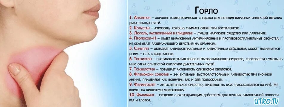 Простуда в горле фото Сыпь на теле и боль в горле - найдено 83 картинок