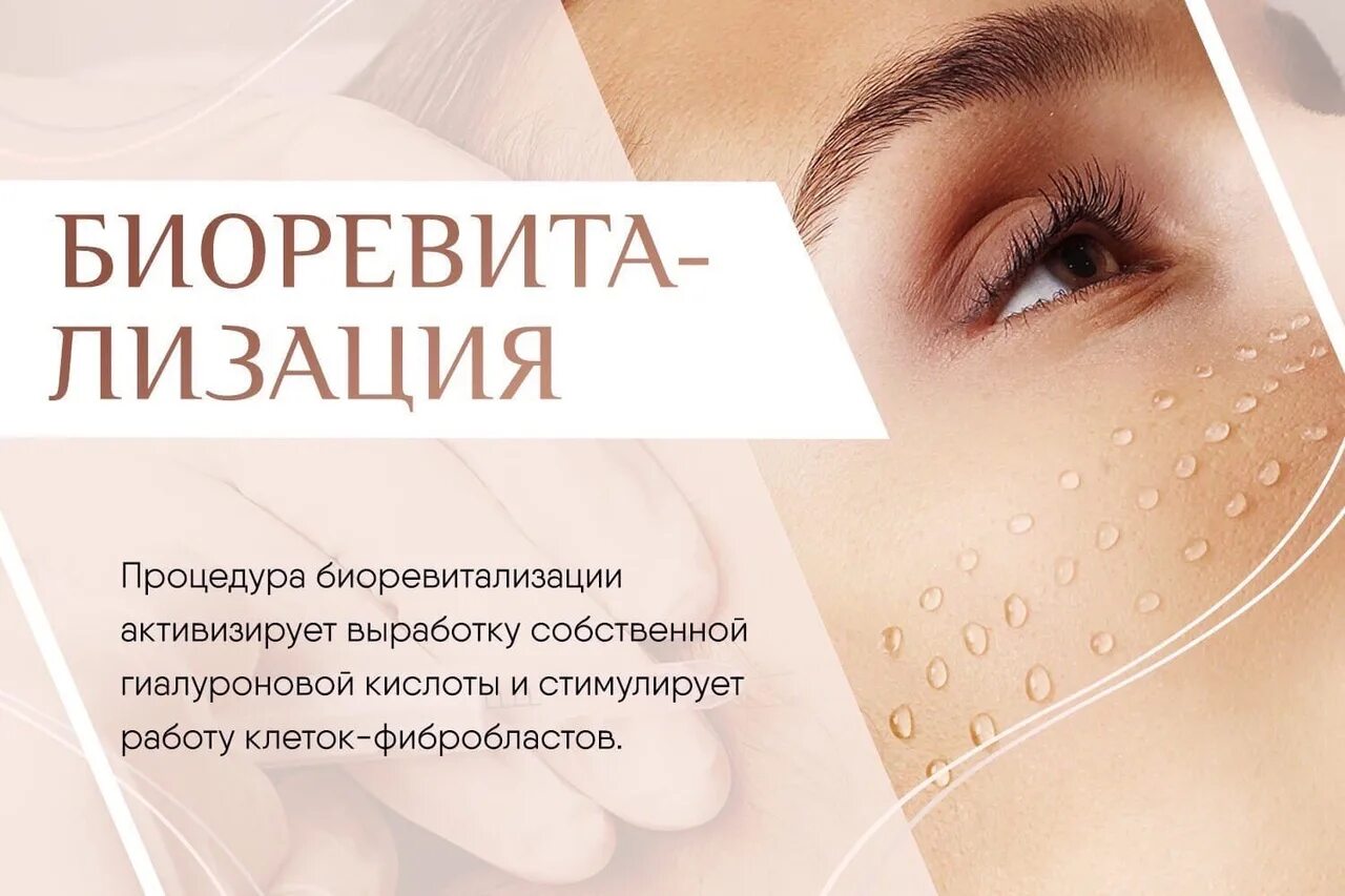 Процедура биоревитализация лица отзывы фото White Fox "Beauty & Medical Княжье Озеро" :: Инъекционные методики в салонах кра