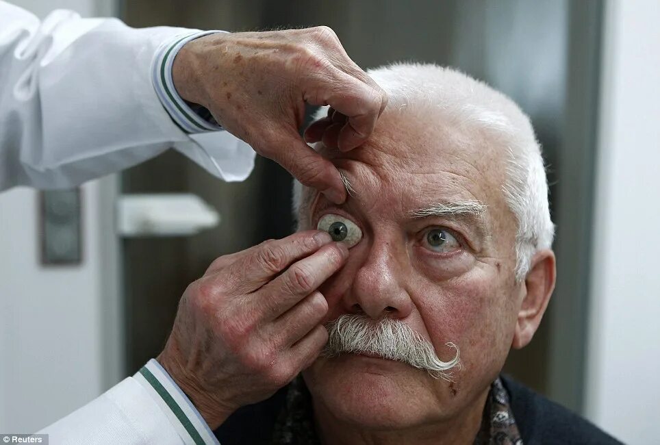 Протез глаза фото How glassmaker's incredibly realistic prosthetic eyes are giving hope to victims