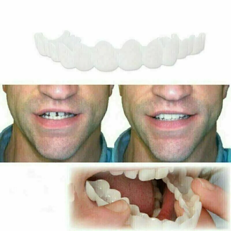 Протез передних зубов верхней челюсти фото Snap On False Teeth Upper + Lower Dental Veneers Dentures Tooth Cover Set Hot eB