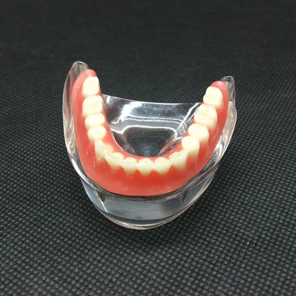 Протез верхней челюсти на присосках фото Dental Overdenture Inferior Teeth Model With 2 Implant Demo Teeth Study Model 60