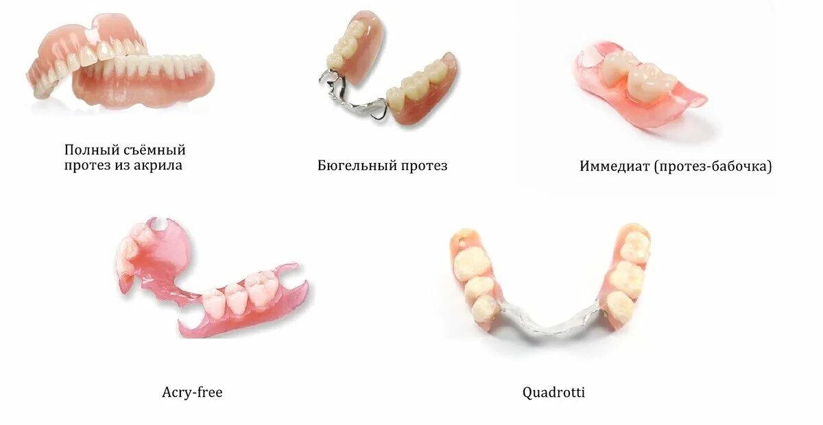 Протезирование зубов виды какой протез лучше фото Какой съёмный зубной протез лучше? Виды и цены. Сеть стоматологических клиник "Р