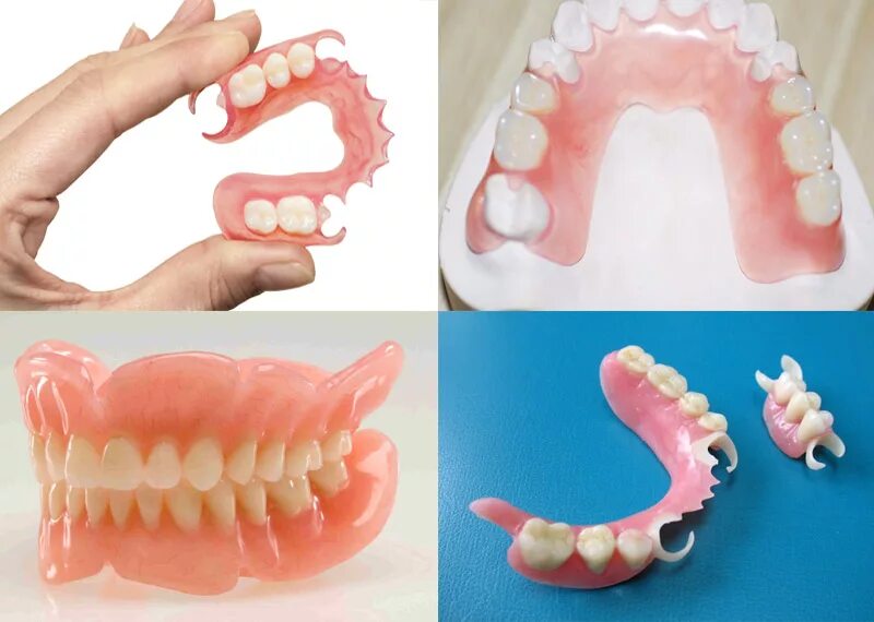 Протезы зубов виды фото Съёмные протезы зубные в Твери от 18300 рублей - установка, протезирование