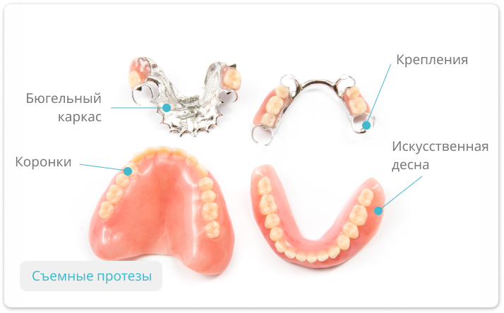 Протезы зубов виды и цены фото Съемные протезы зубов: цены, изготовление и виды протезирования - Стоматология Е