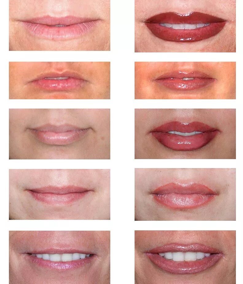 Противопоказания после перманентного макияжа губ Before & After- Permanent Lip Makeup . Permanent makeup eyeliner, Lip permanent 