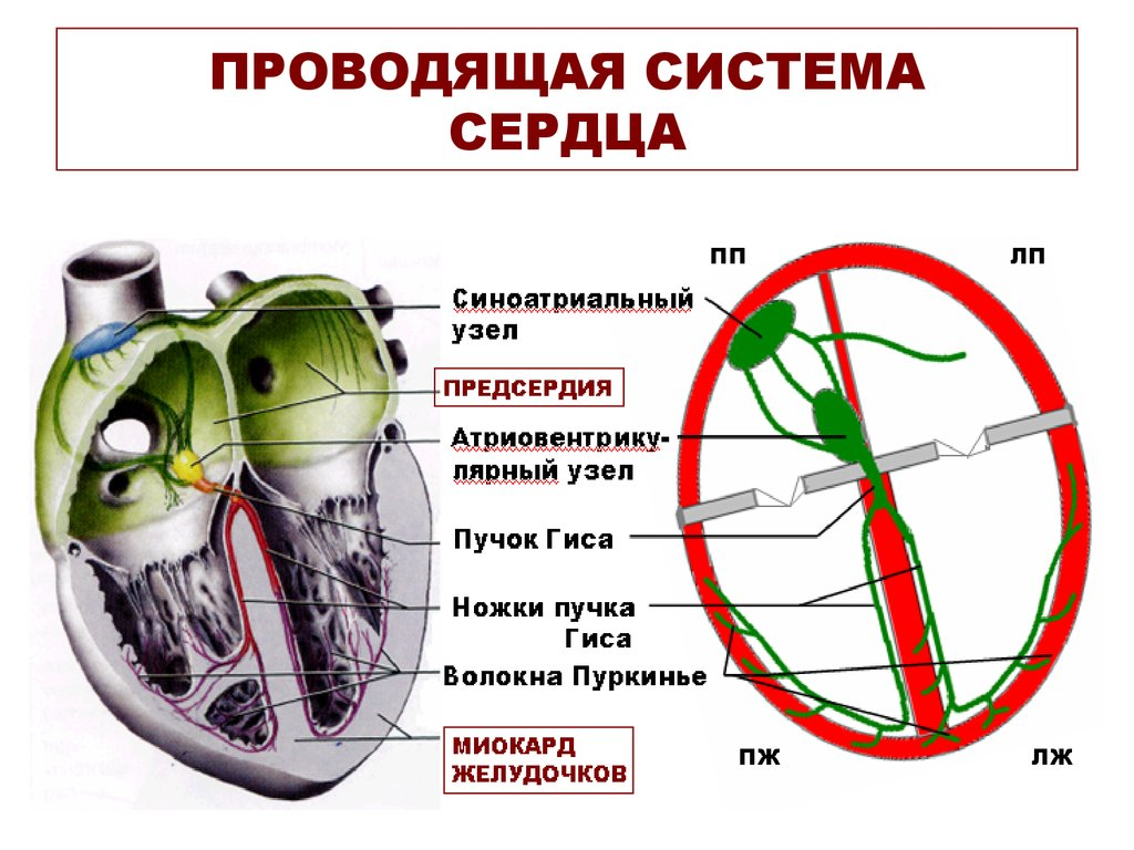 Проводящая система сердца фото Паузы сердечного ритма за счет блокады: как мы спасли пациента от установки кард