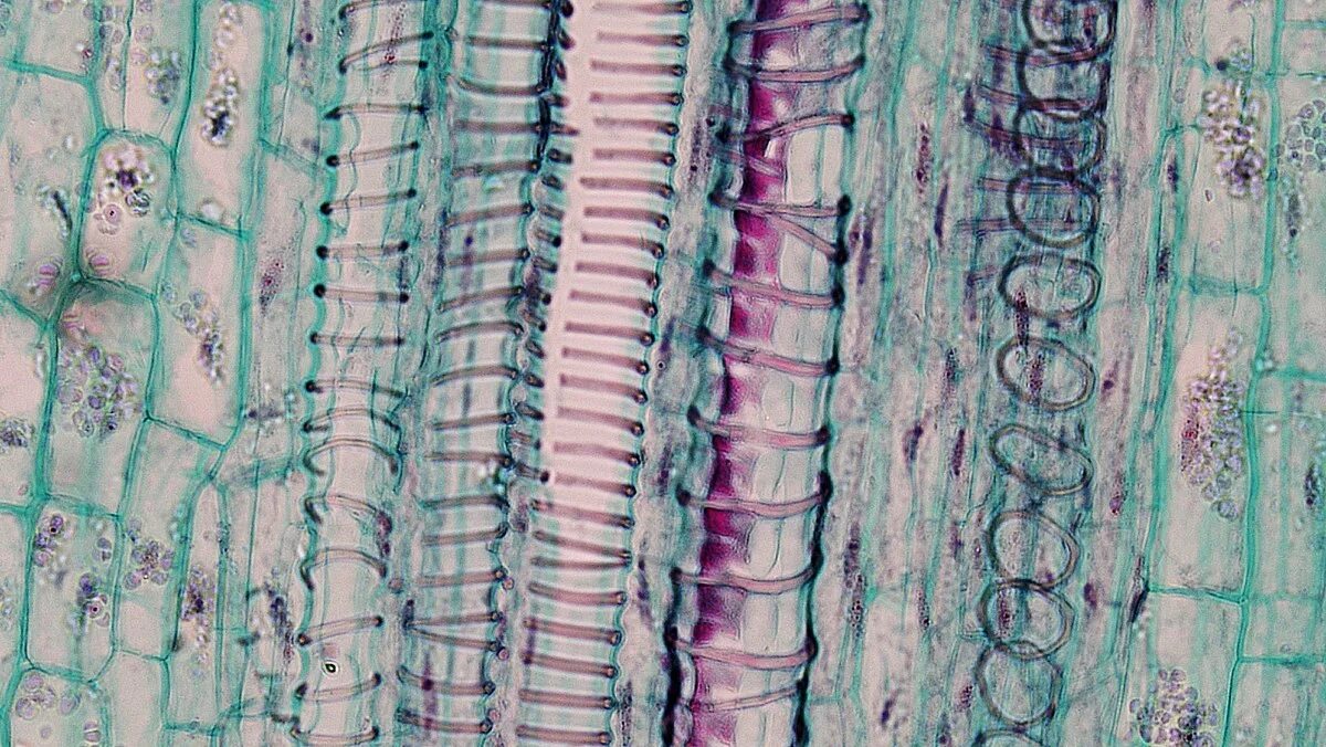 Проводящая ткань фото под микроскопом File:Herbaceous Dicot Stem Xylem Vessels Cucurbita (35463815631).jpg - Wikipedia