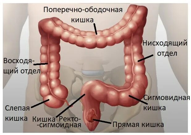 Прямая кишка фото внутри Все о раке ободочной кишки - лечение в Москве в Университетской клинике МГУ им. 