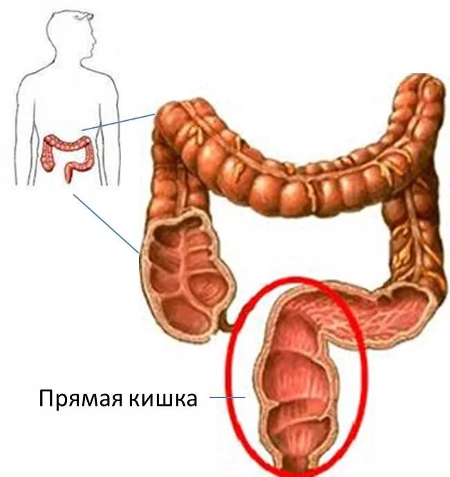 Прямая кишка фото внутри Проктит: причины, симптомы, методы диагностики и лечения проктита