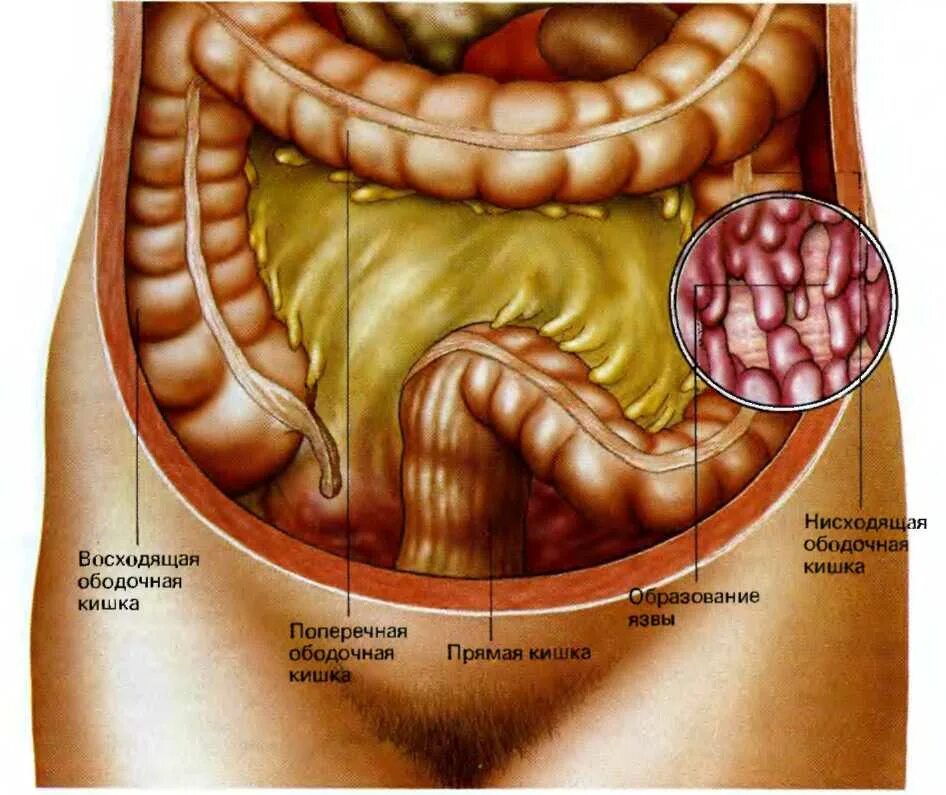 Прямая кишка фото внутри Сигмовидная кишка где находится фото у женщин: найдено 83 изображений