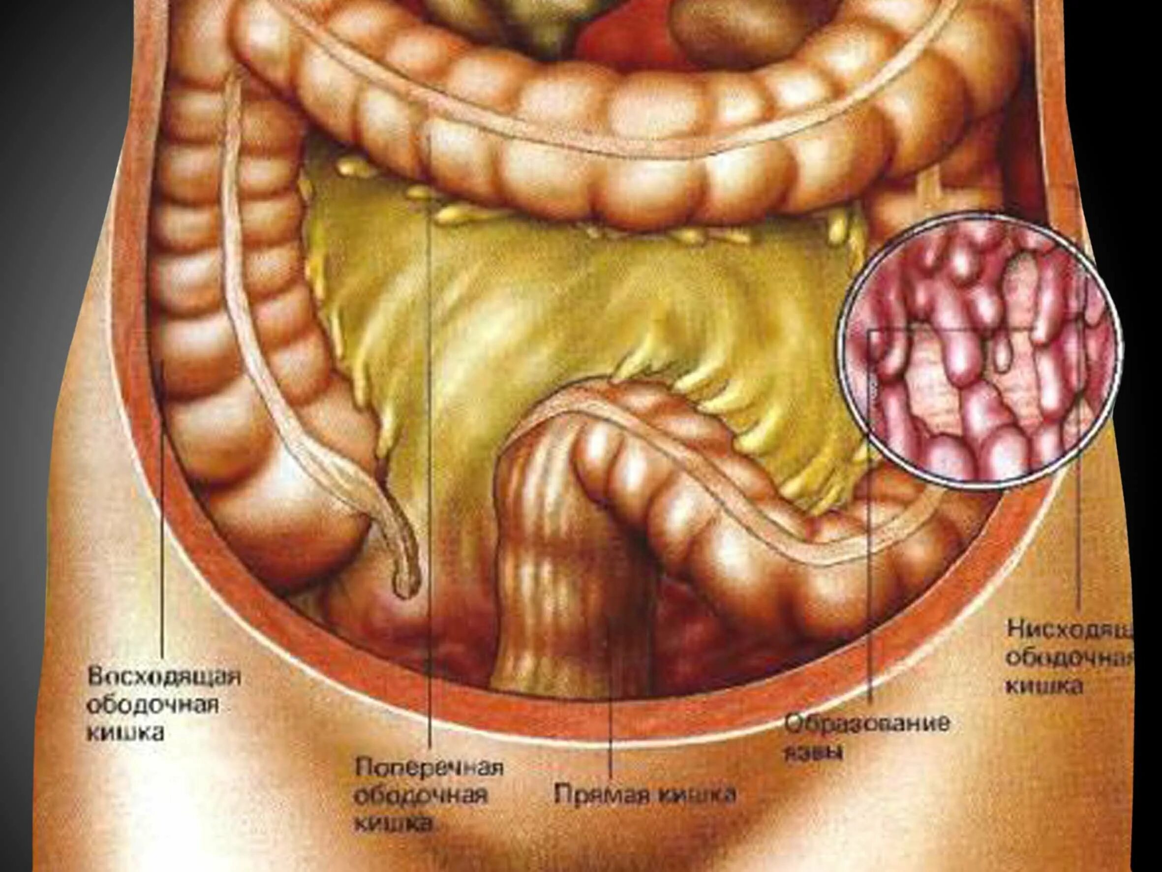 Прямая кишка строение у мужчин фото Строение кишечника человека в картинках у женщин