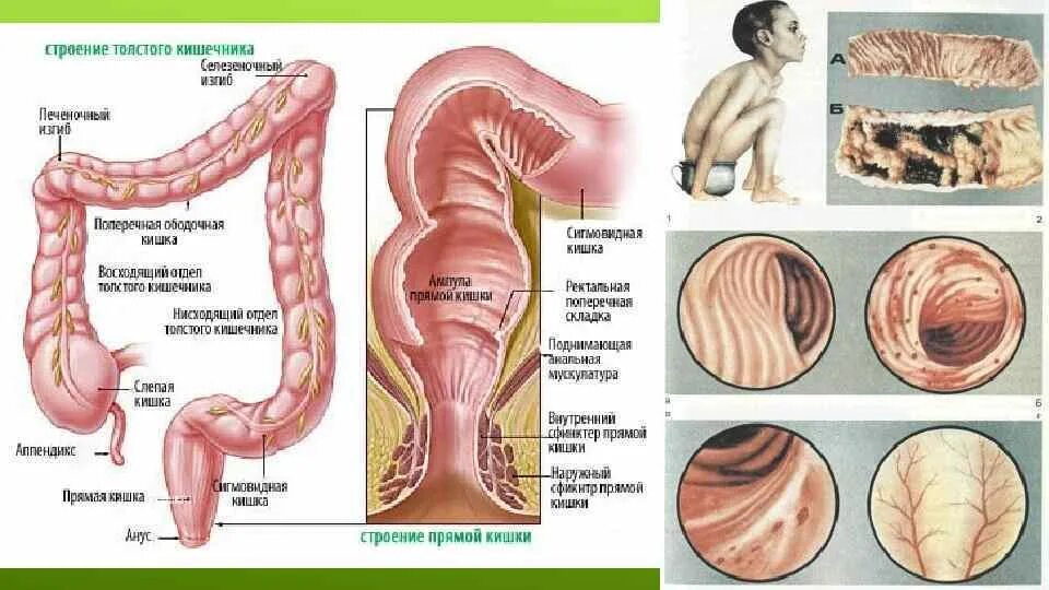 Прямая кишка строение у женщин фото Канал прямой кишкой