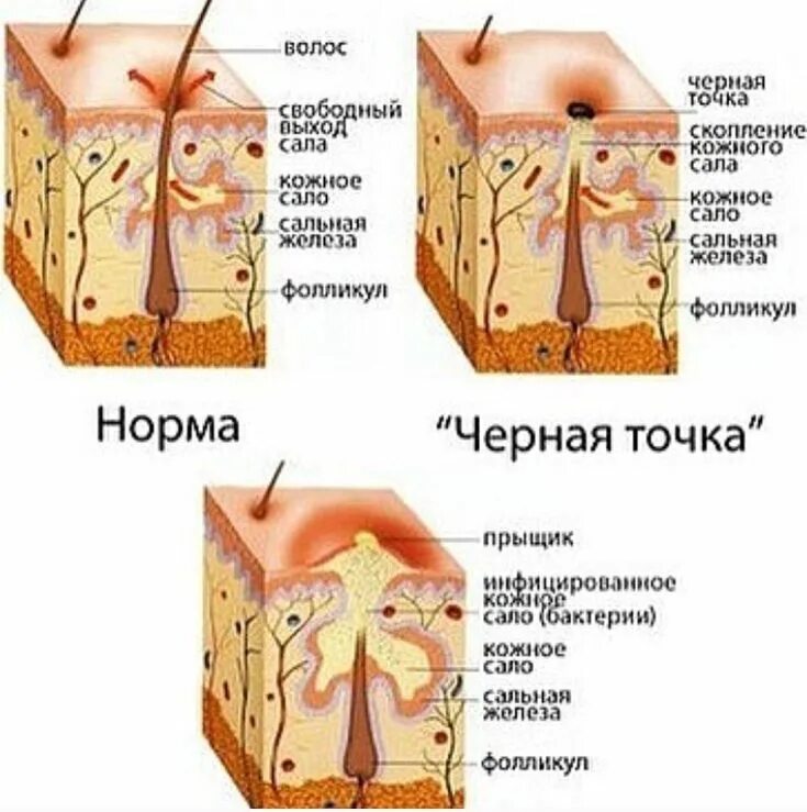 Когда на лице появился прыщик и его заметила моя мама Пикабу