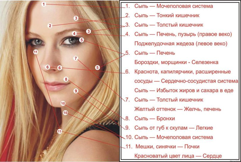 Прыщи на лице у женщин фото Психологические причины болезней кожи лица. Акне, Кожа, Лицо