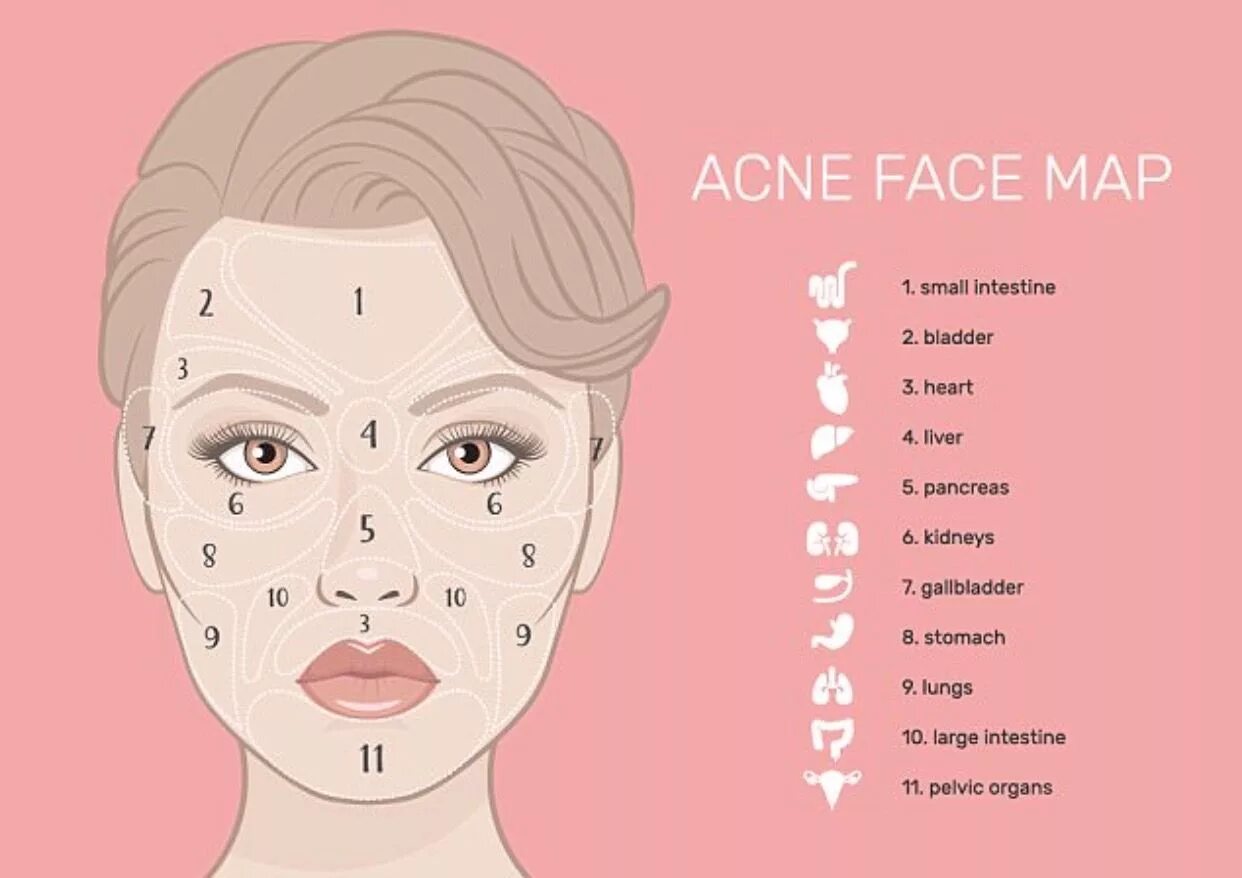 Прыщи на лице у женщин фото Acne Map and Your Health Pimples on face, Face mapping acne, Face mapping