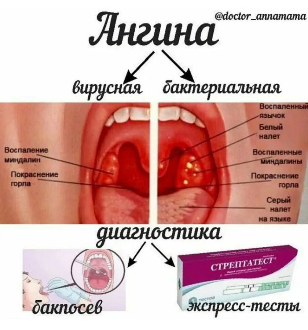 Прыщи на задней стенке горла фото Для информации 2021 Борьба деток с онко-гем заболеваниями ВКонтакте