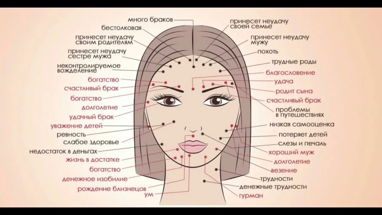 Прыщи схема расположения на лице Знаки судьбы на теле человека. - YouTube