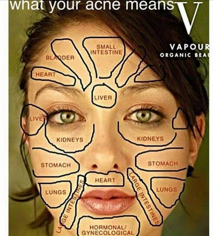 Прыщи схема расположения на лице Pin by Jason Tyler on BONKERZ Face mapping, Beauty health, Health and beauty tip