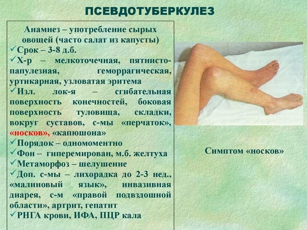 Псевдотуберкулез симптомы фото Псевдотуберкулез у детей: 6 предрасполагающих факторов, 5 групп симптомов, метод