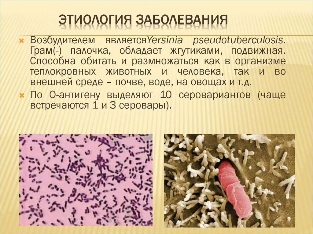 Псевдотуберкулез сыпь фото Псевдотуберкулёз - презентация онлайн