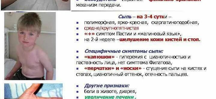 Псевдотуберкулез сыпь фото Архивы Инфекционист - Страница 5 из 15 - Совет медика