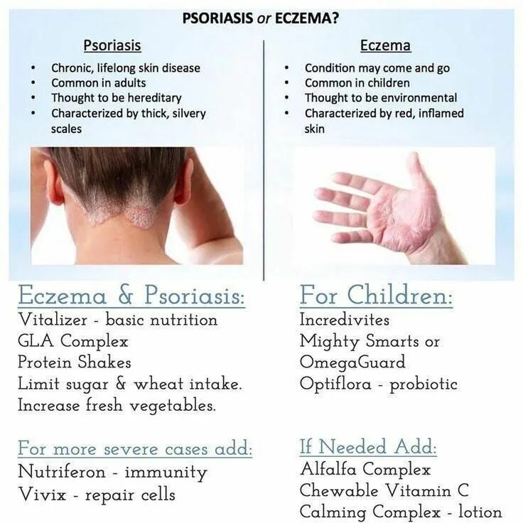 Псориаз и дерматит отличия на фото These Tips Can Help You Cope With Eczema Find out more at the image link. #Eczem