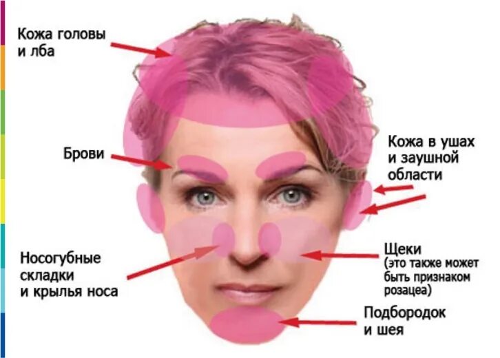 Псориаз и себорейный дерматит отличия фото DERMAQUEST " Себорейный дерматит и розацеа - в чем разница Статьи Отзывы Купить