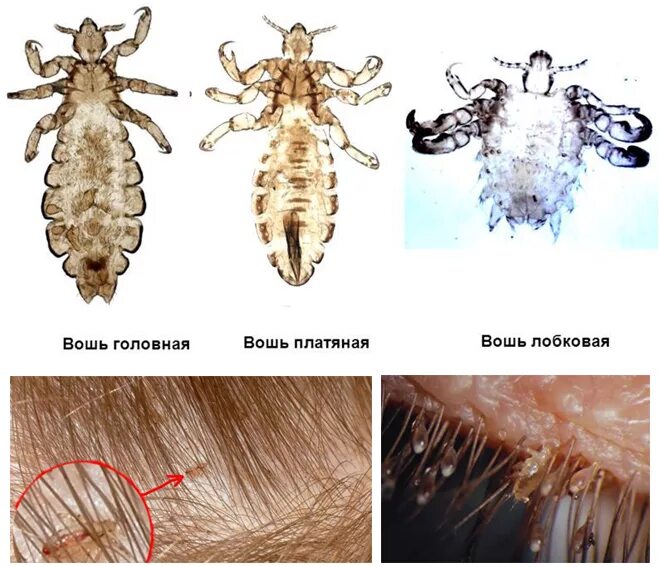 Пухоеды и вши как выглядят Педикулёз © ГУО "Борковская средняя школа"