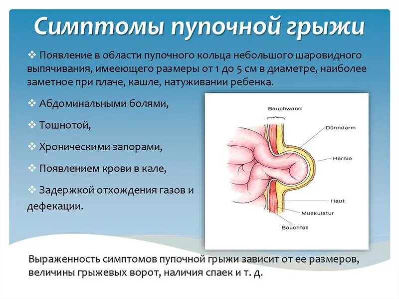 Пупочная грыжа начальная стадия фото Пупочная грыжа у детей: симптомы