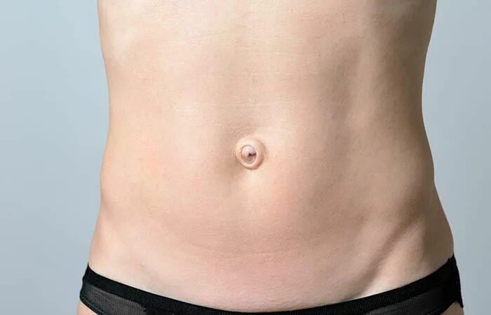 Пупочная грыжа симптомы фото у мужчин Are You An Innie Or An Outie Belly Button? Here’s What It Means! Belly button, B