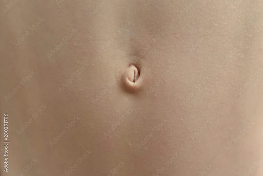 Пупочная грыжа у взрослых фото как выглядит Navel of a white woman, seen from the front. Stock Photo Adobe Stock