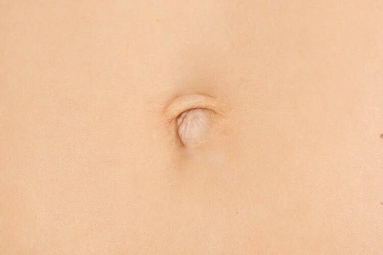 Пупок снаружи фото There are six types of belly buttons. and here’s what yours says about you The S