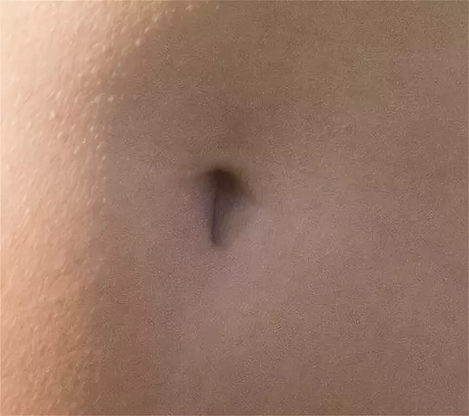 Пупок снаружи фото Файл:T-shaped navel.jpg - Википедия