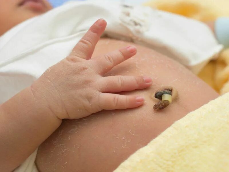 Пупок в месяц фото Aprenda a cuidar do umbigo do recém-nascido - Baby education, Belly button, Bell