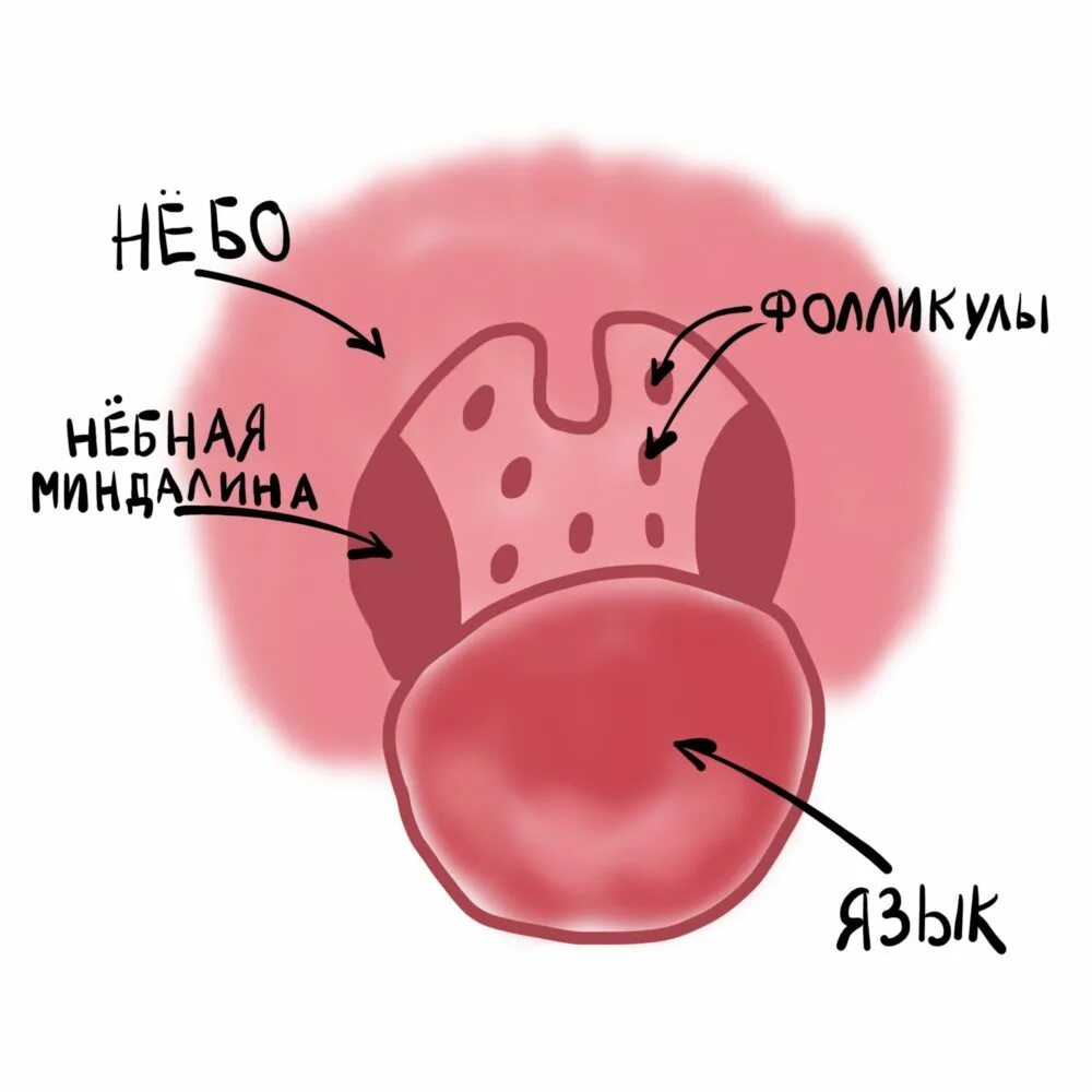Пупырышки на задней стенке горла фото Фолликулы в горле - Арт Минск.ру